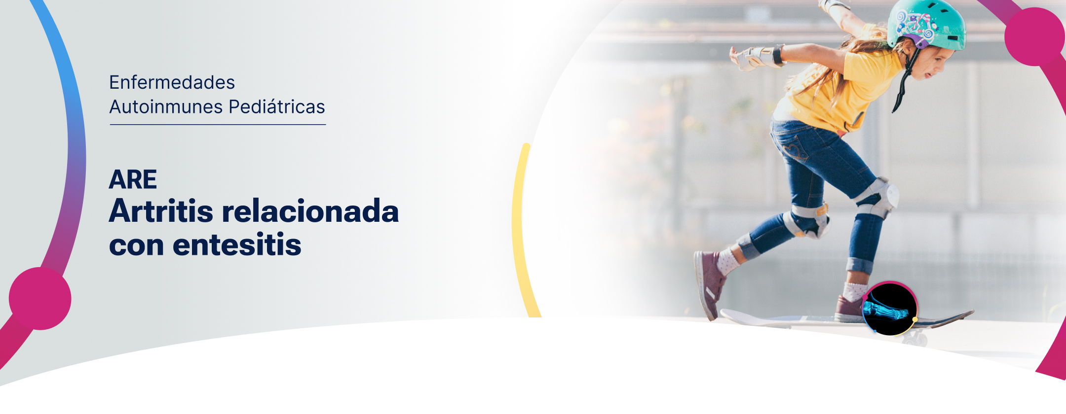 Enfermedades autoinmunes pediatricas banners princiapl (4)